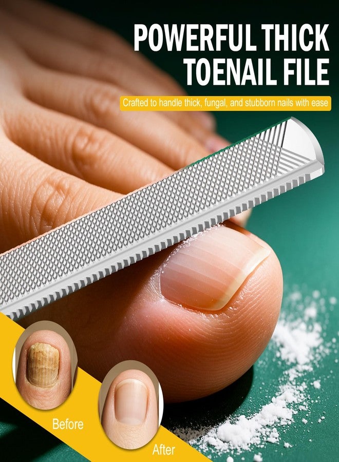FVION Toenail File for Thick Nails and Toenail Lifter, 2pcs Stainless Steel Nail File and Ingrown Relief Set, Heavy Duty Metal Emery Board for Seniors, Men & Women Pedicure Tool (Green) - Image 2